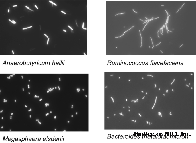 Who Inhabits Our Gut? Introducing the Human Gut Microbiota | SpringerLink
